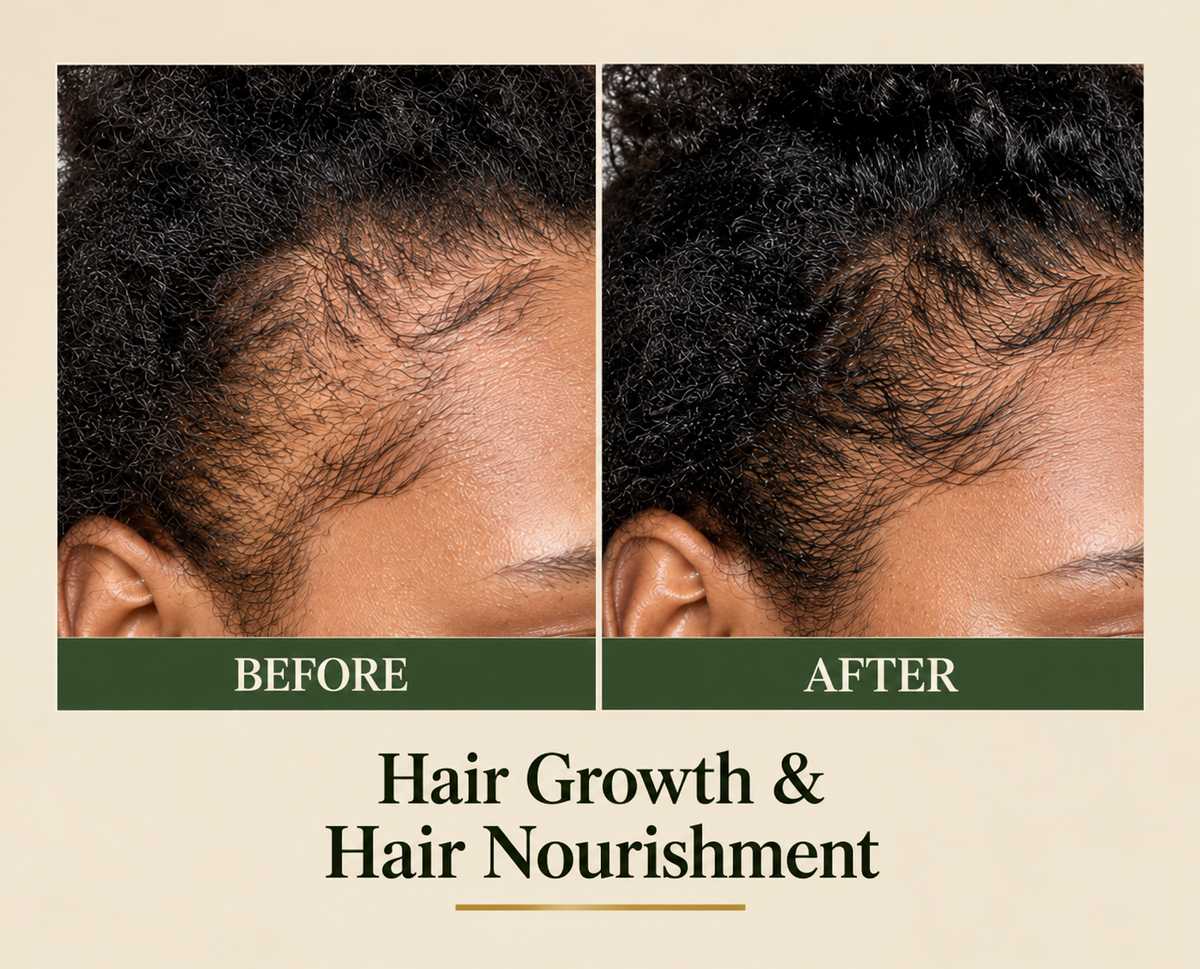 Pure Honduran Batana Oil – Natural Hair Care | 118 ml my batana oil batana