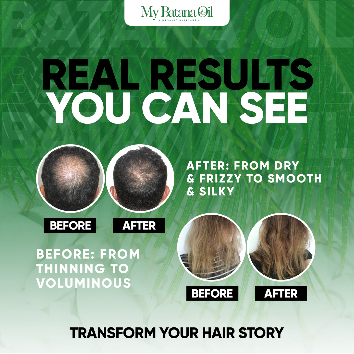 Aceite Batana para el Crecimiento del Cabello – 100 % Natural y Sin Refinar - 118 ml de aceite para el crecimiento y la reparación del cabello | Aceite capilar natural Batana