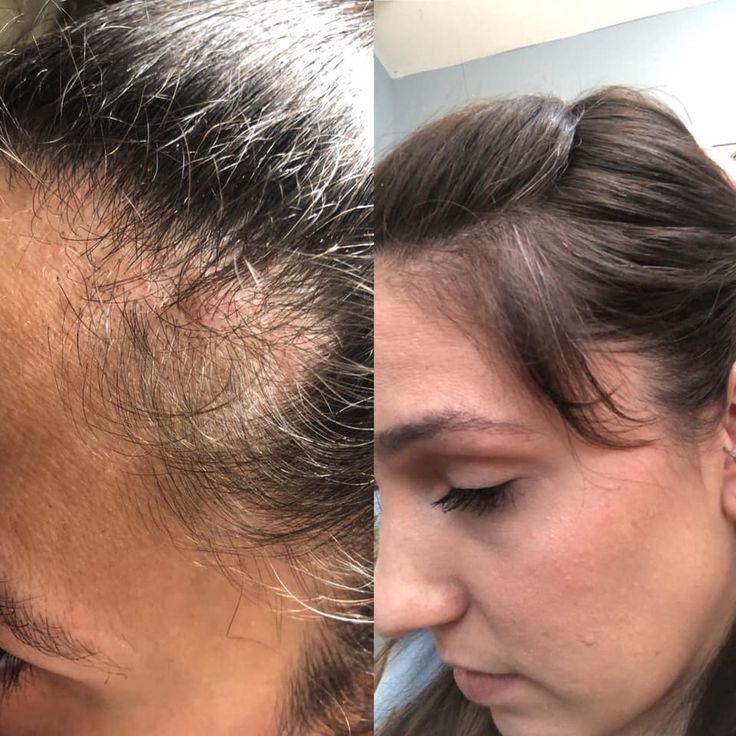 Aceite Batana para el Crecimiento del Cabello – 100 % Natural y Sin Refinar - 118 ml de aceite para el crecimiento y la reparación del cabello | Aceite capilar natural Batana