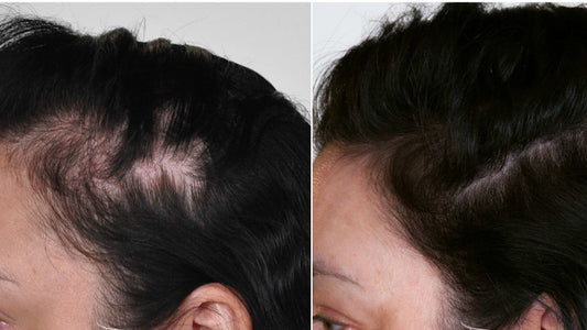 How Fast Does Batana Oil Regrow Hair? A Comprehensive Guide in 2025