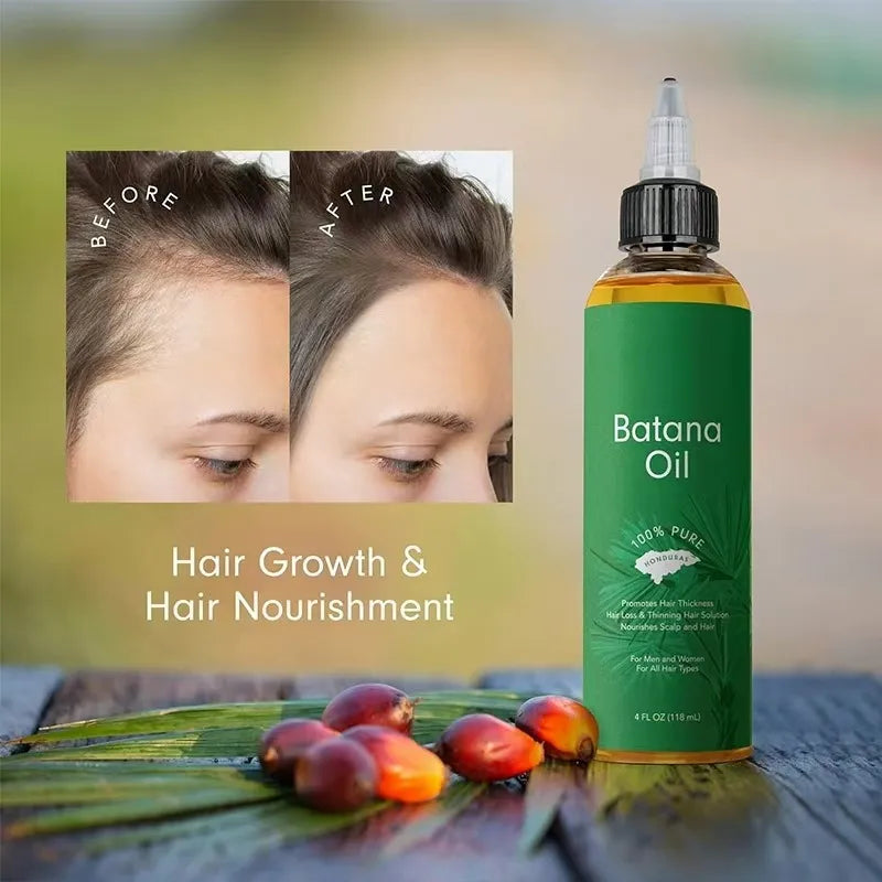 100% Raw Batana Oil Hair Care – 118ml Oil for Hair Growth & Repair | Natural Batana Hair Oil