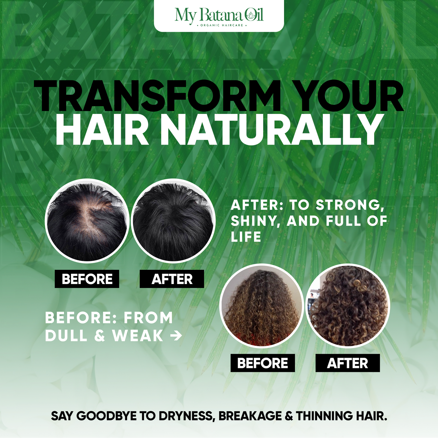Shampoo Batana Oil -  Soothing Scalp Oil Control & Remove Dandruff 300ml