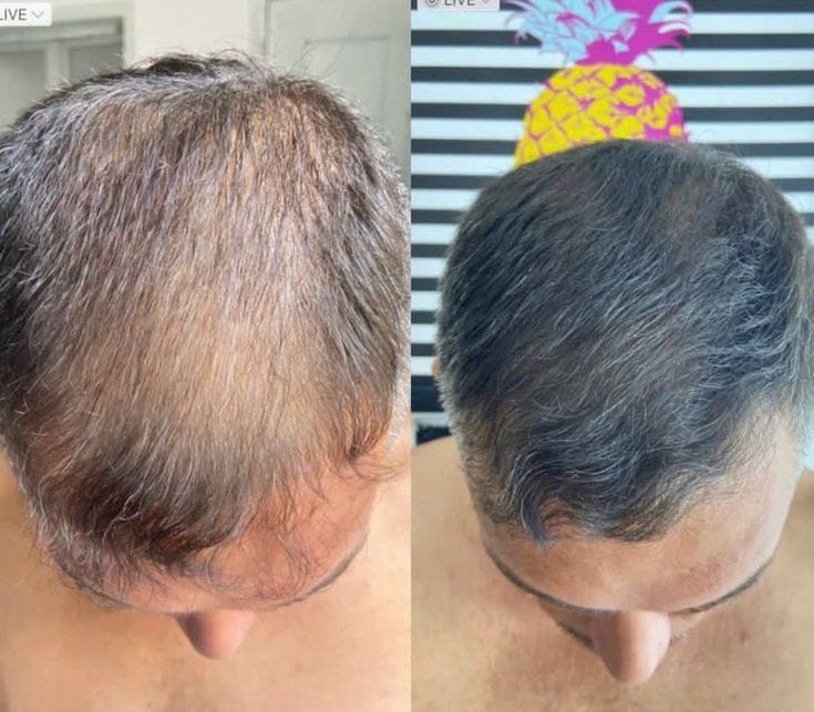 Shampoo Batana Oil -  Soothing Scalp Oil Control & Remove Dandruff 300ml